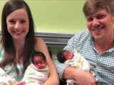 Une maman de couleur blanche donne naissance à 3 bébés noirs Les différenc