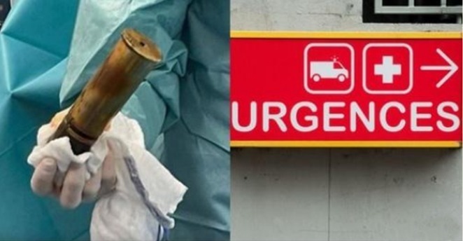 À 88 ans, il se présente aux urgences avec un obus dans le… rectum et provoque l’évacuation de l’hôpital