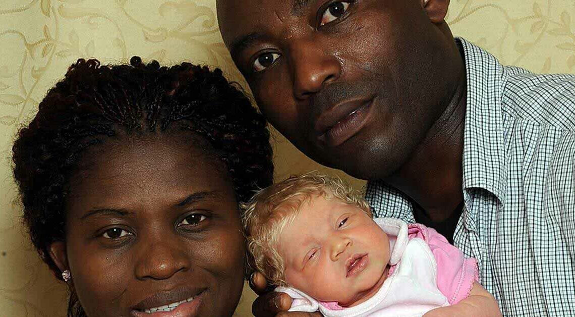 L’Étonnante Naissance d’un Bébé Blanc aux Yeux Bleus par des Parents Noirs