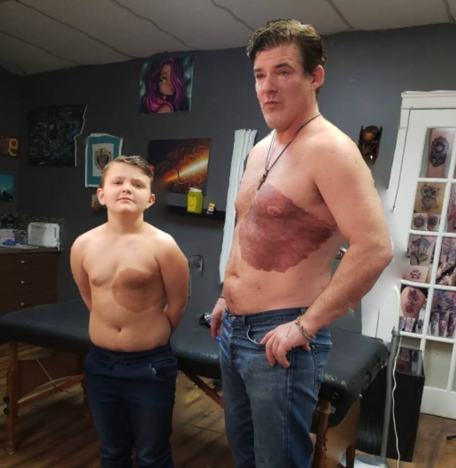 Un papa se fait tatouer la même tache de naissance de son fils
